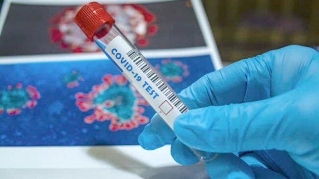 😷Ermənistanda koronavirusunun yeni ştammı aşkar edilib.